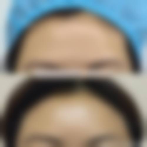 四、驻马店德医美医疗美容诊所特色项目