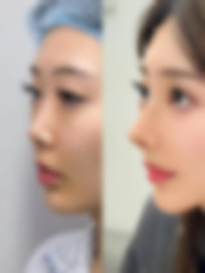 五、复发问题及应对