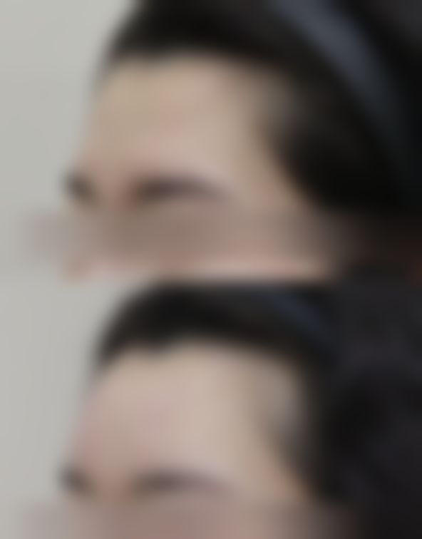 二、常见治疗手段解析