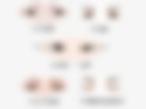 {水光针除皱效果好不好呢？了解适用皱纹类型与维持时间再做判断！ 