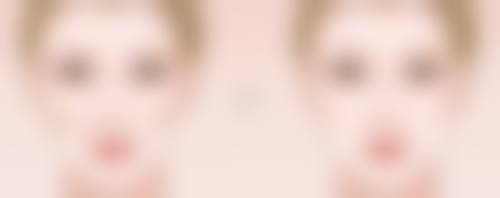 六、理性看待水光针除皱