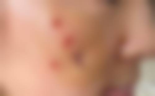 八、长治悦美医疗美容诊所预约方式