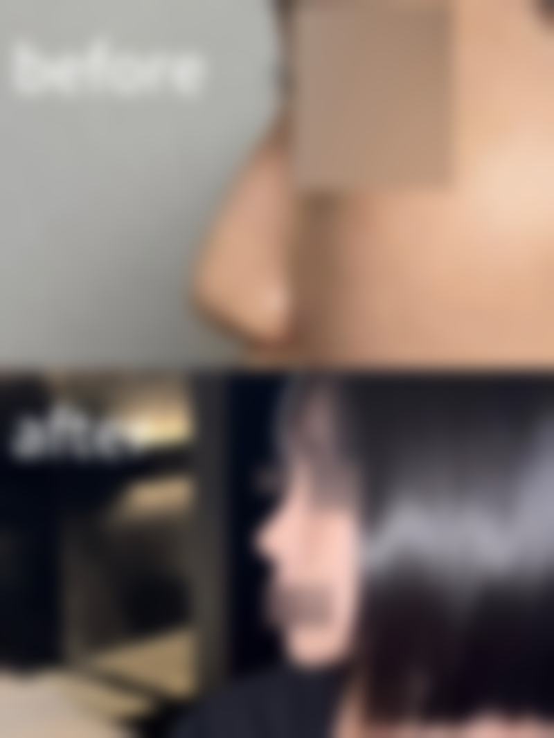 二、成都锦江菁薇整形医院怎么样？