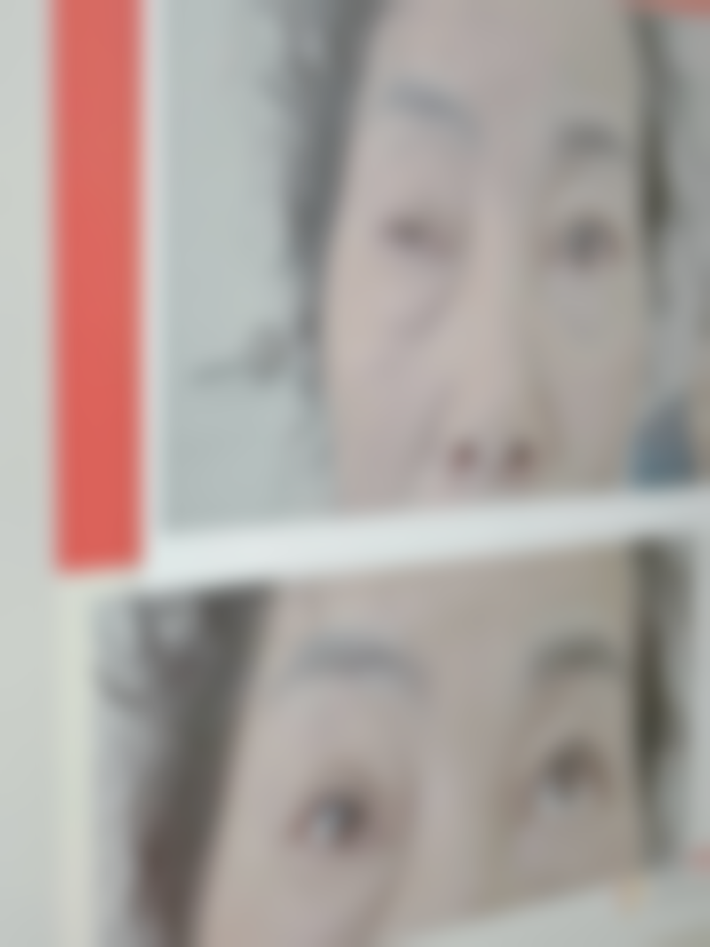 五、隆鼻一般能管多久:总结