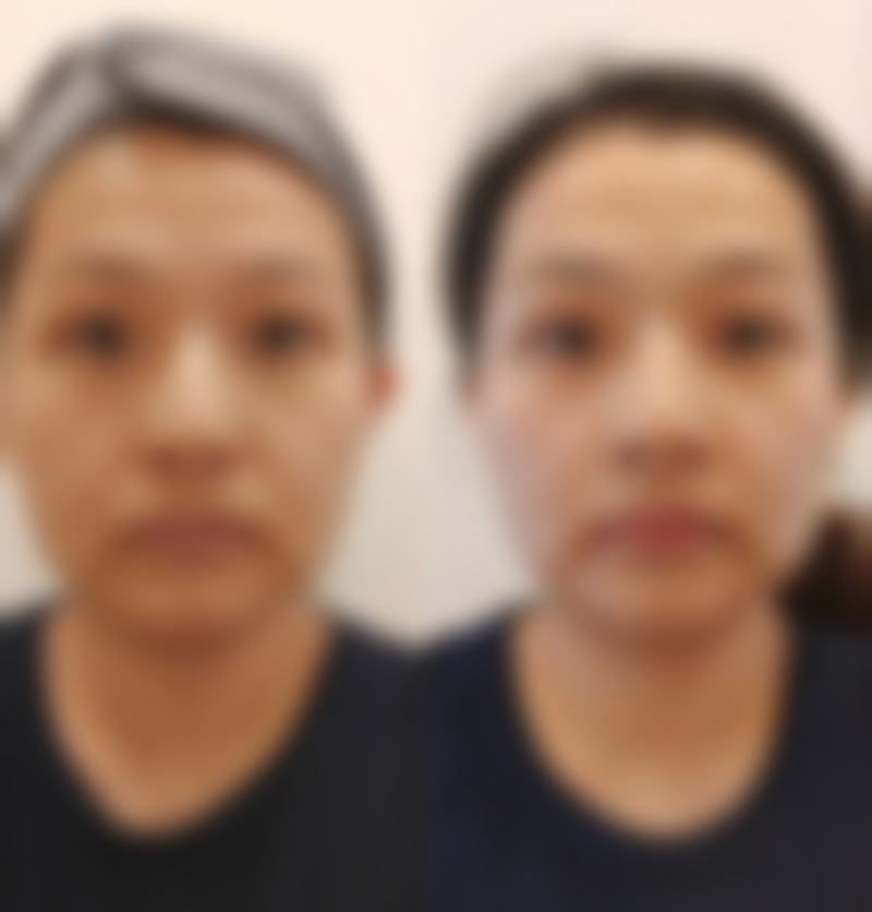 二、合肥吴氏佳美医疗美容怎么样？