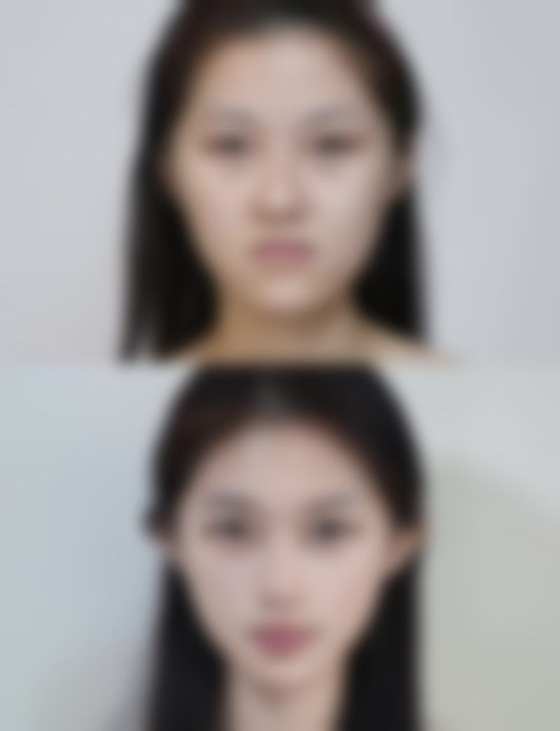 五、结合日常护理提升除皱成效