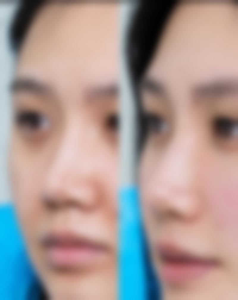 五、女生怎么去除眼袋之个性化方案与心态调整