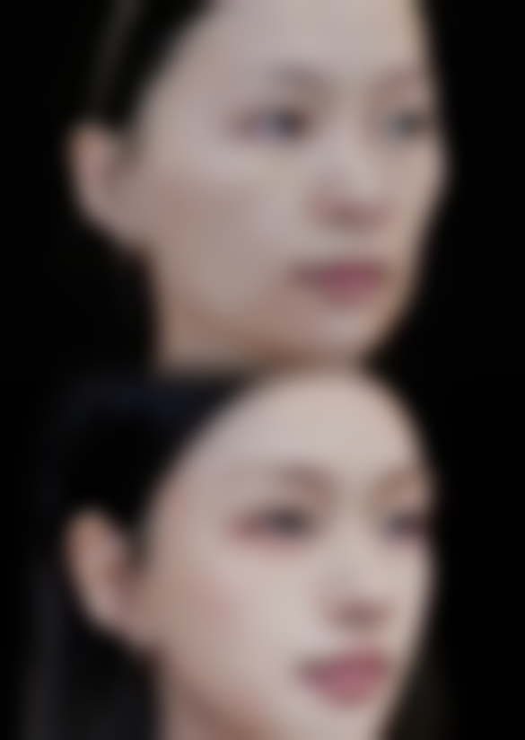 四、水光针除皱的适用人群及注意事项