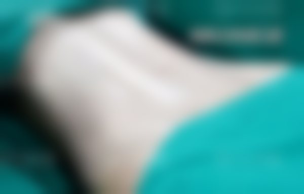 二、选择医院和医生