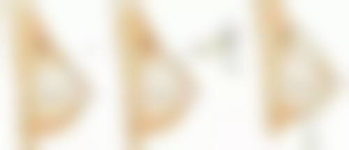 四、额头的疤痕修复注意事项