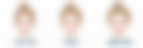 六、脸上有疤痕能去吗：保持积极心态