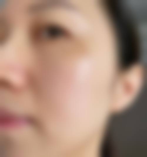 八、韩国美泊门抗衰老整形外科预约方式