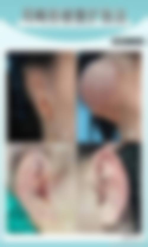 五、宁德华美医疗美容门诊部价格表