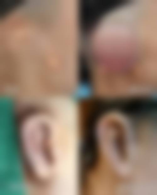 四、宁德华美医疗美容门诊部特色项目