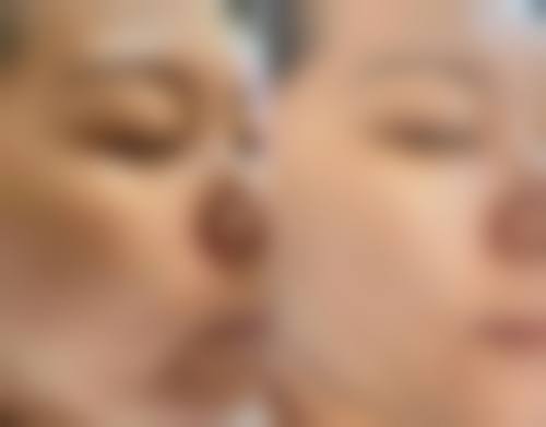 六、李晓梅真实的患者评价