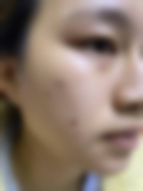 七、宁德华美医疗美容门诊部预约方式