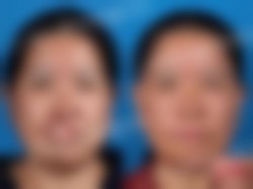 五、韩国心动整形外科价格表