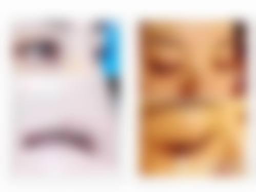 八、韩国心动整形外科真实的患者评价