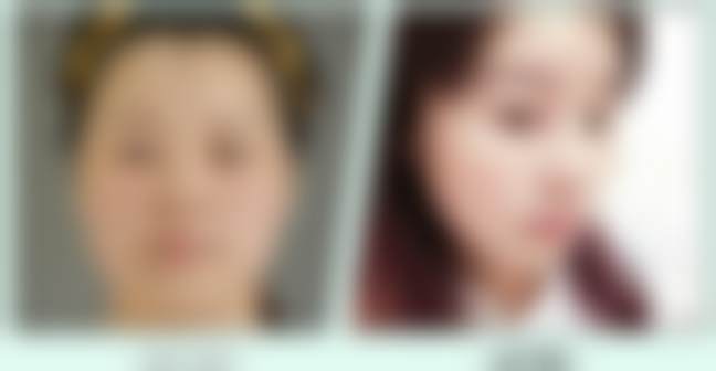 四、北京禾美嘉医疗美容门诊部的项目优势