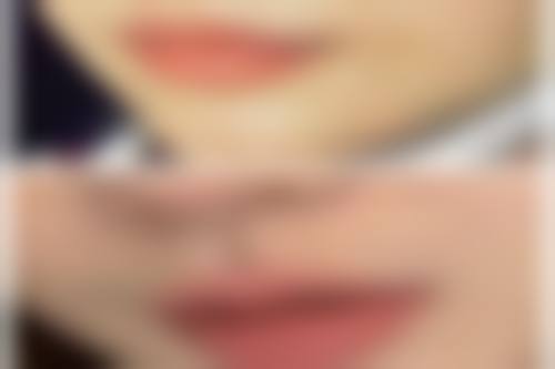 二、婴儿怎么看双眼皮之年龄与发育的影响