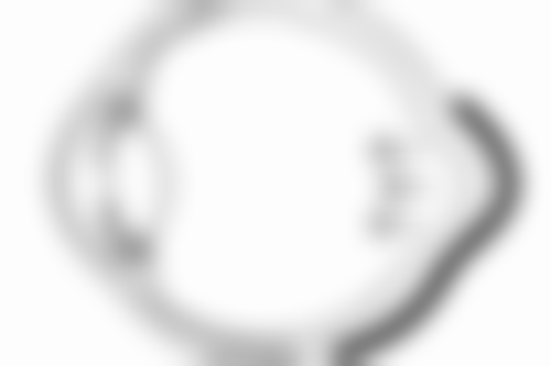 一、阴道紧缩术后同房时间的大致范围