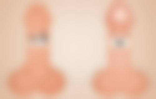 四、关于做完双眼皮用疤克的常见问题解答