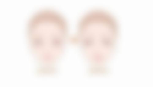 {做双眼皮肿了怎么快速消肿？冰敷热敷饮食护理全攻略，必要时可吃这些药 