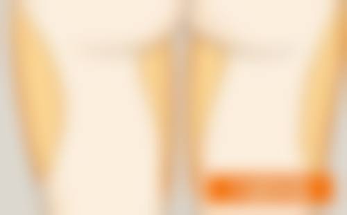 一、婴儿怎么看双眼皮之观察眼皮褶皱