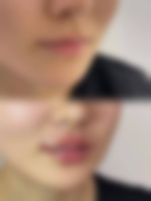 四、宿迁市中医院烧伤整形科特色项目