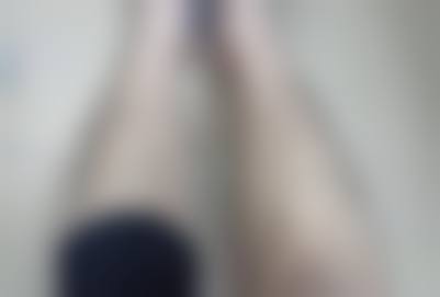 八、大连沙河囗许英医疗美容诊所真实的患者评价