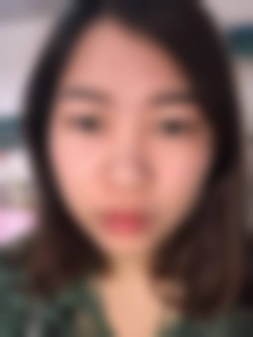 四、大连沙河囗许英医疗美容诊所特色项目