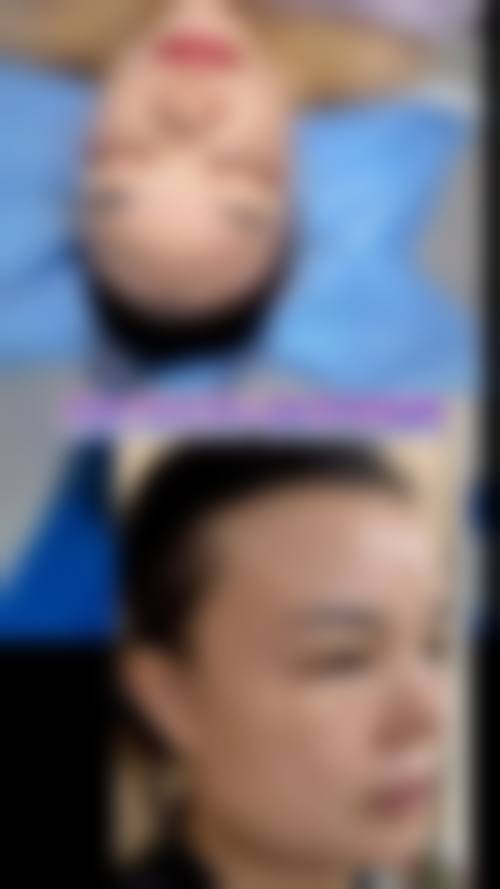 五、清潭healin医院价格表