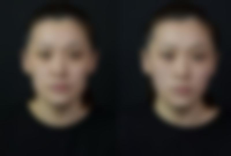 五、尹奇玉怎么预约？