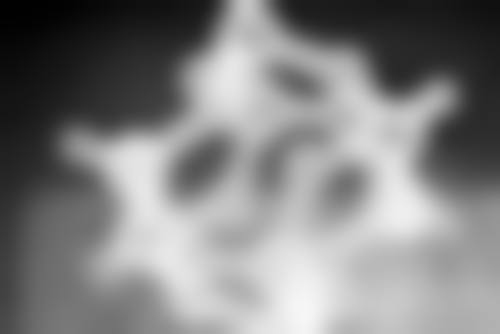 男士怎么去除眼袋之总结