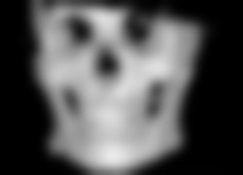 一、隆鼻术后短期内同房的风险