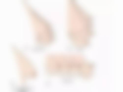 五、保护美观成效的注意事项