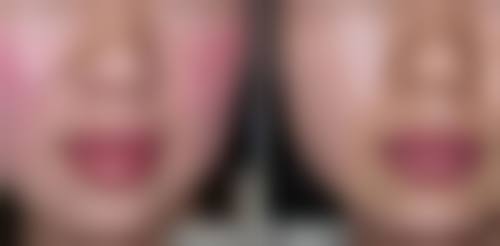 八、爱尔丽(福州)医学美容机构真实的患者评价