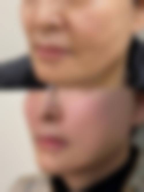 二、郑州汇颜医疗美容医院怎么样？