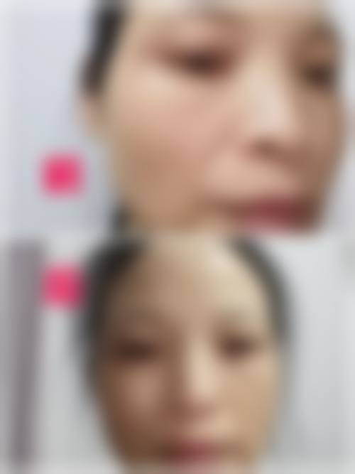 二、临沂美吉拉医疗美容门诊部怎么样？