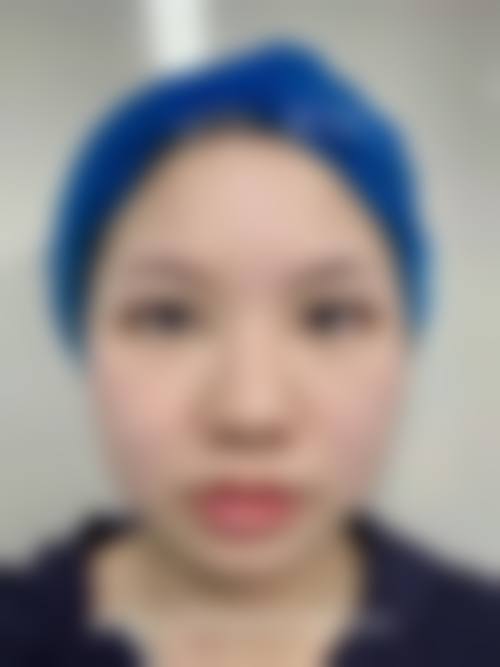 二、爱尔丽(福州)医学美容机构怎么样?