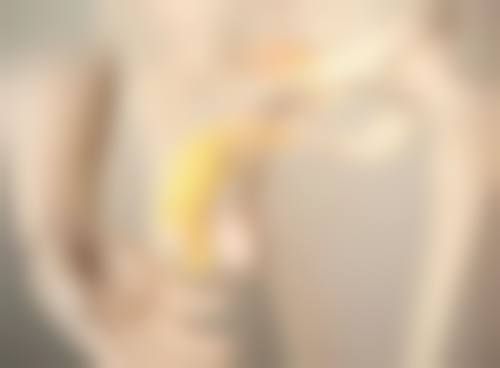 二、韦婷医生：玻尿酸淡化眼纹的骨干医生