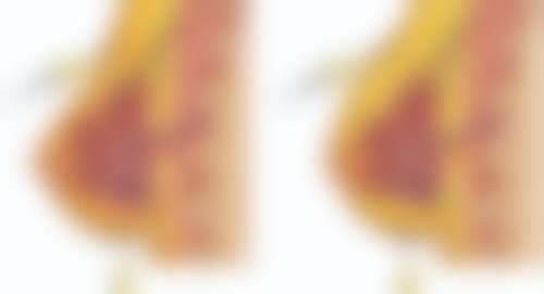 {做双眼皮抽脂好吗？了解适合情况、风险及费用，为美丽决策提供参考 