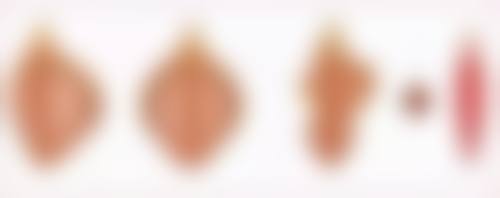 四、许昌正美韶华医疗整形相关项目