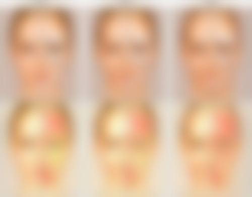 三、隆胸后不同阶段的常见现象及处理方式