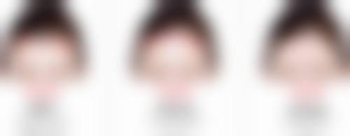 一、脸上打除皱针的常见后遗症和副作用