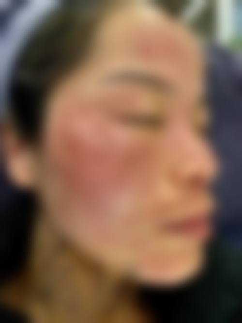 五、张瑜玲怎么预约？