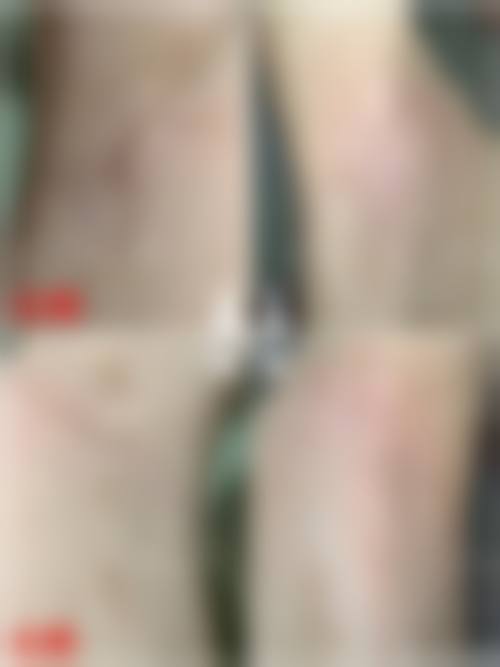 八、淮北市苗医生祛痘祛斑医院真实的患者评价