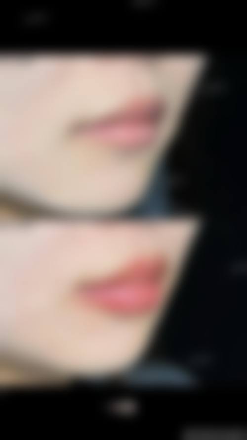 四、烟台壹美天成整形医疗美容医院特色项目