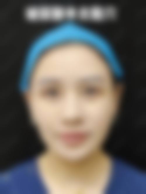 三、烟台壹美天成整形医疗美容医院诊疗项目有哪些？