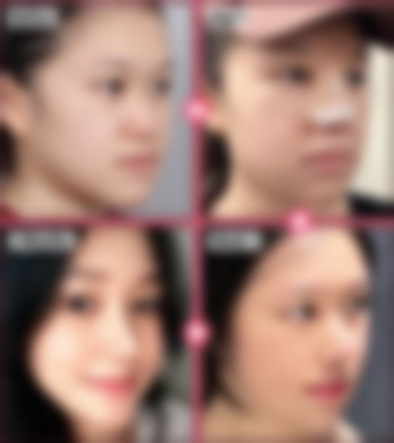 六、烟台壹美天成整形医疗美容医院价格表